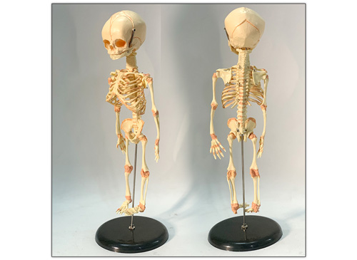 ZRJP-103A婴儿骨骼模型